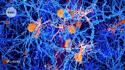 The brain cells linked to protection against dementia